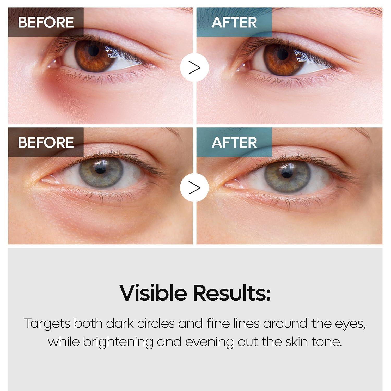 Dr.Melaxin TX Retinalsome Double Effect Eye Cream 40g 3
