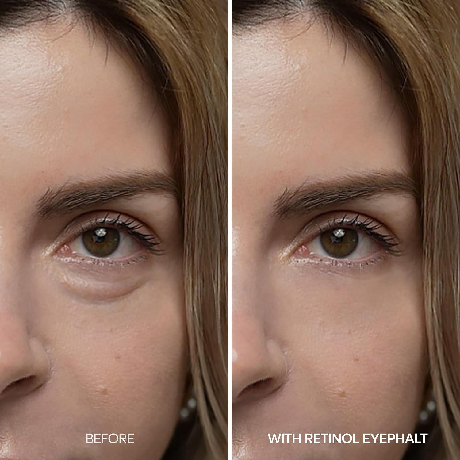 Dr.Melaxin RETINOL EYEPHALT EYEBAG CREAM 10g 4
