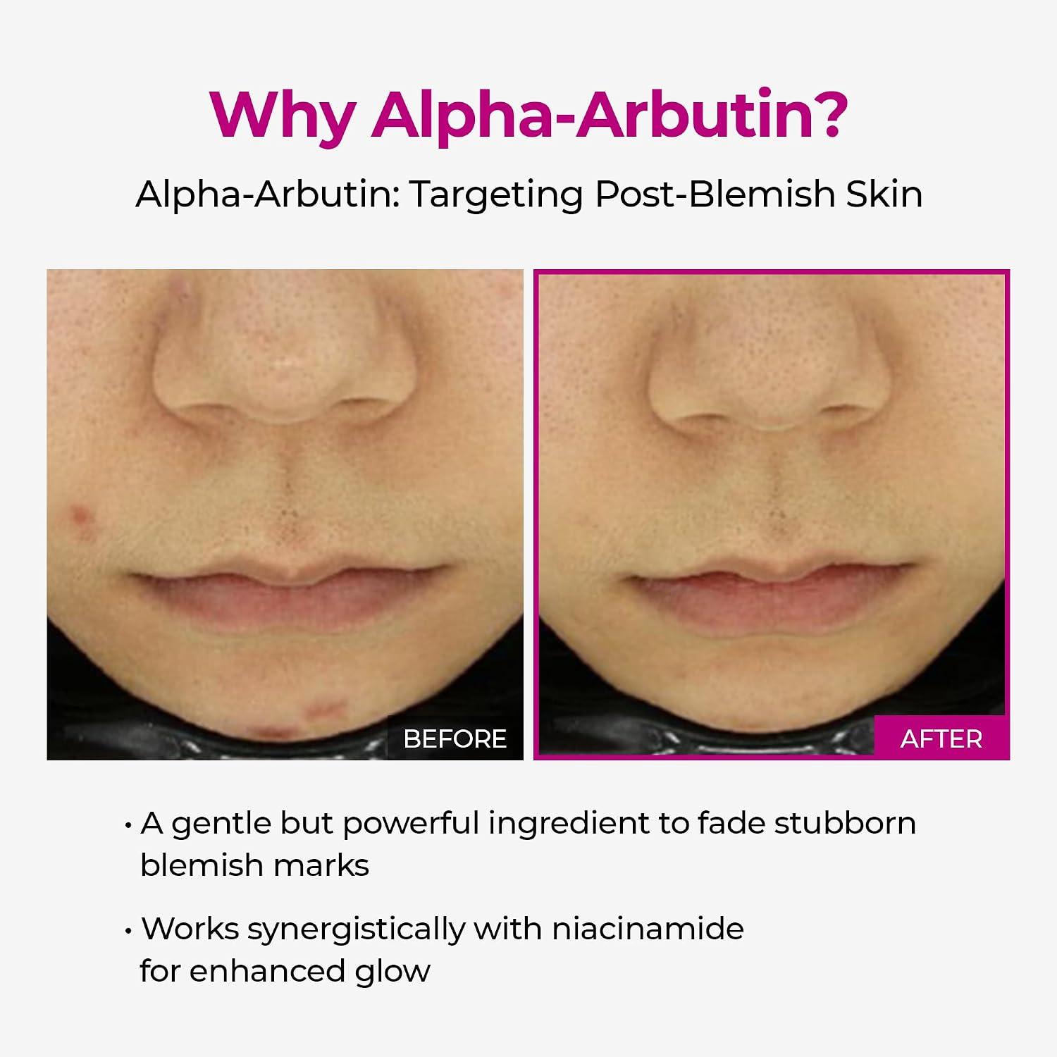 Dr.Melaxin Cemenrete Picotonic Shot Ampoule 30ml 4