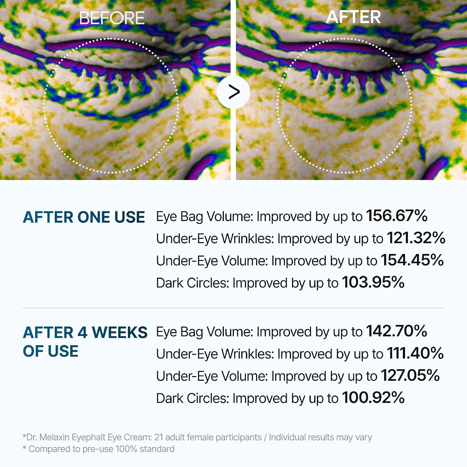 Dr.Melaxin Eyephalt Eyecream for Eyebags 10ml 8